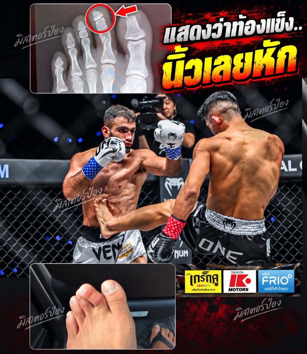 Masaaki Noiri Breaks Finger, Fight Against Marat Grigorian Postponed at ONE Championship